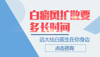 白癜风的常规检查系统详解