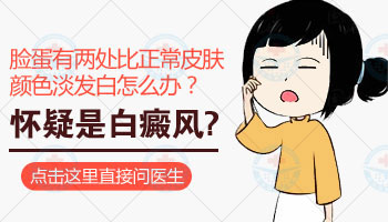 Wood灯检查亮白色的意义与应用