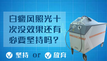 Wood灯光检查显示灰白色，是白癜风吗？