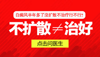 白癜风病因及检查全解析