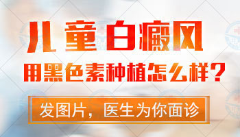 做真菌检查不是白癜风，还有必要再照伍德灯吗？