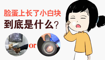 白斑照光敏感度高与低：专业分析与探讨