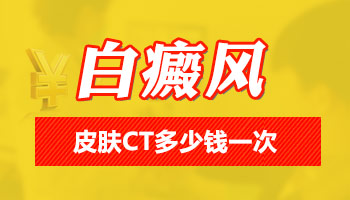 皮肤CT检测白斑是否为白癜风：准确性解析