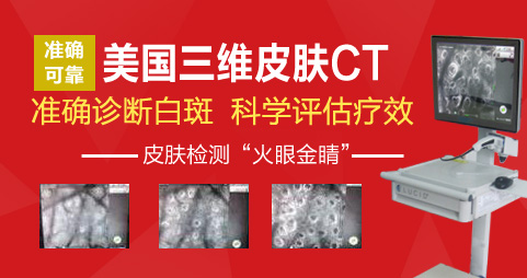 白癜风做308激光不能停吗？