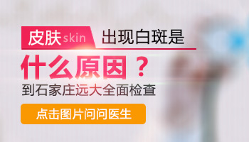 白癜风检查项目详解
