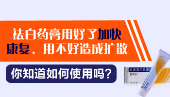 308准分子激光治疗白癜风一般照射时长解析