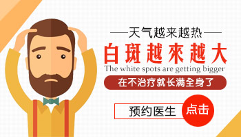 `Wood灯检查白癜风有危害吗`