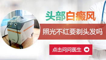身上有白点是什么病？应做哪些检查？