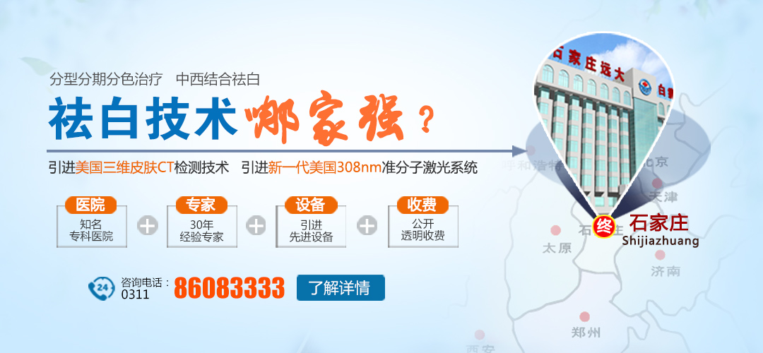 激光治疗青少年白癜风长期未见效的应对策略