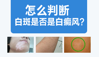白癜风CT检查价格详解