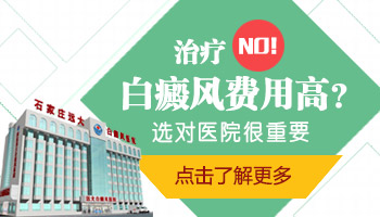 如何检查是否患了白癜风：专业指南与常见问题解答