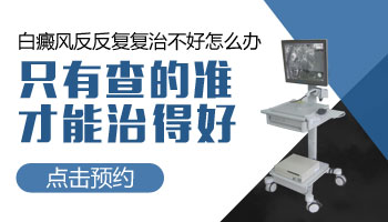 白癜风照射308激光的费用详解