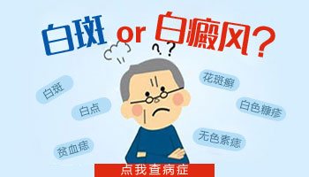 UVB光照治疗白斑:持续时长与效果深度解析