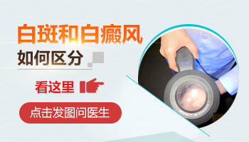 全身局限型白癜风检查全解析