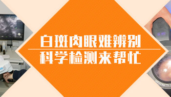 白癜风发展期做308激光治疗效果探讨