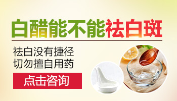 血常规能检查出白癜风吗？