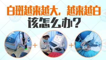 311治疗白癜风见效时间详解