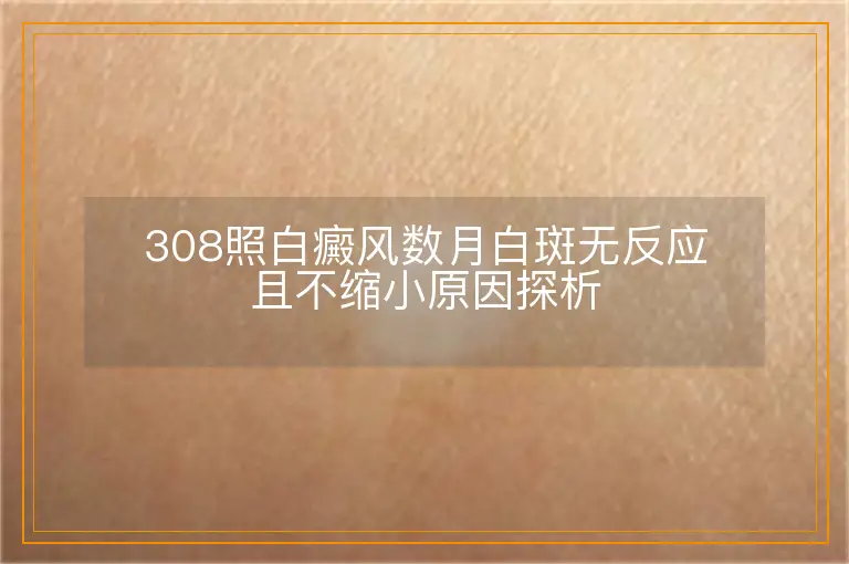 308照白癜风数月白斑无反应且不缩小原因探析
