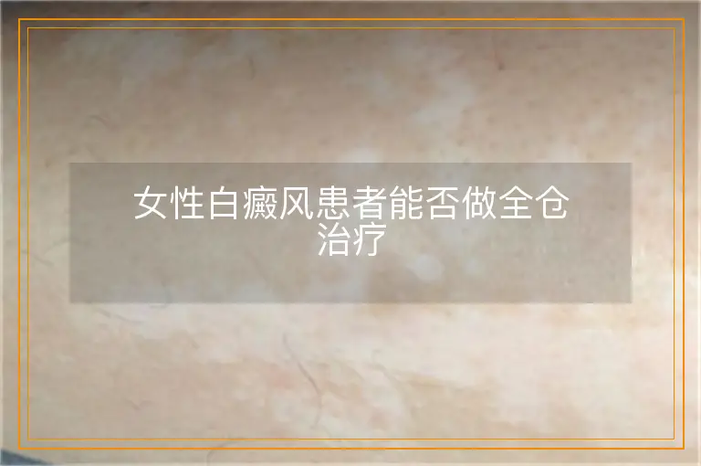女性白癜风患者能否做全仓治疗