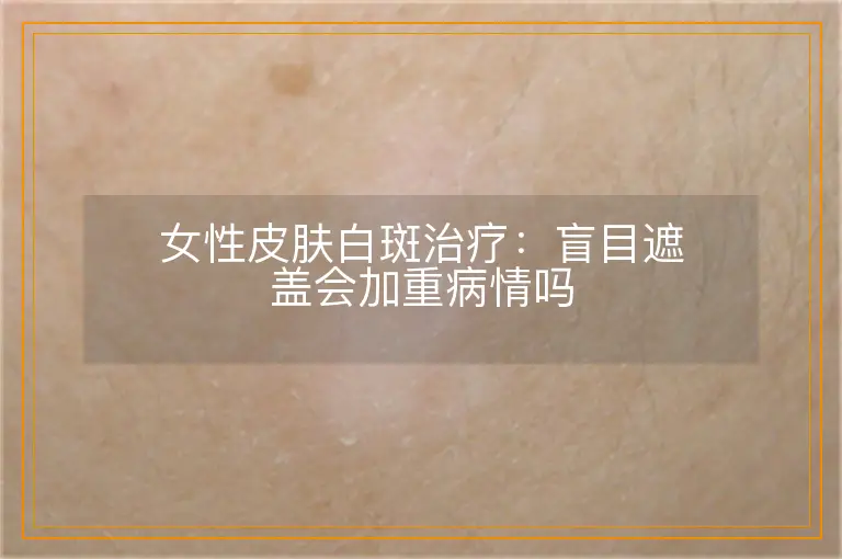 女性皮肤白斑治疗:盲目遮盖会加重病情吗