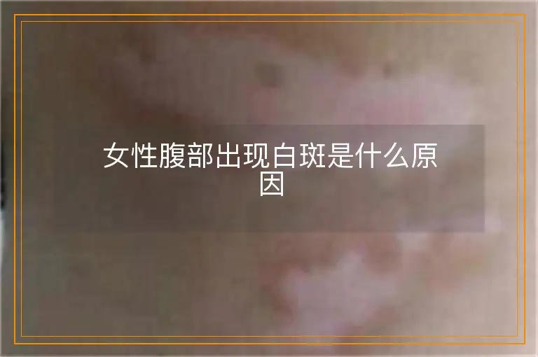 女性腹部出现白斑是什么原因
