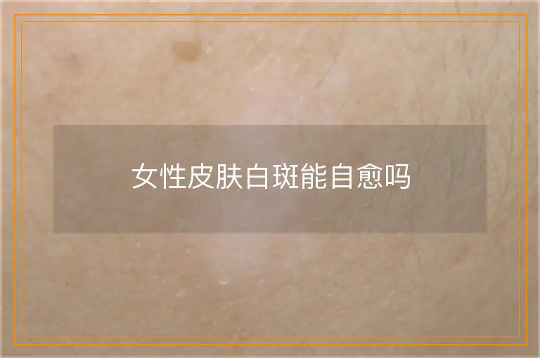 女性皮肤白斑能自愈吗