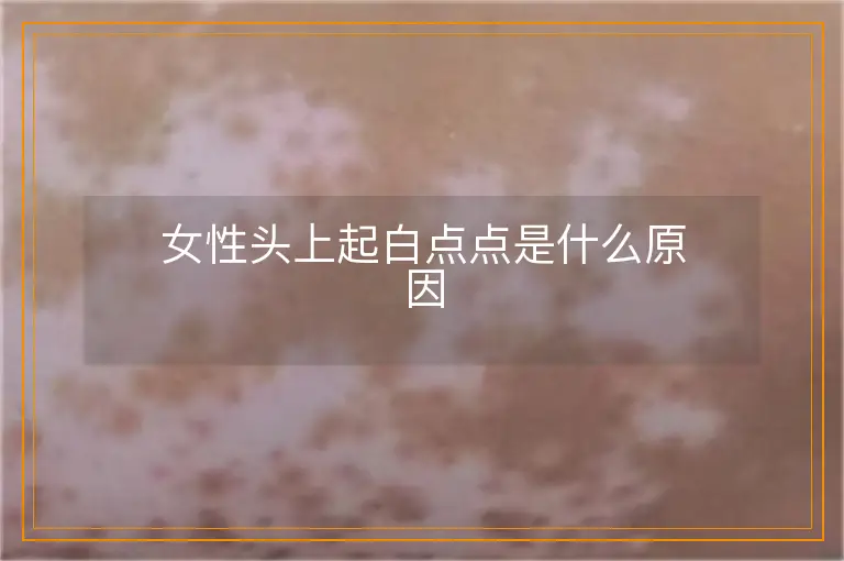 女性头上起白点点是什么原因
