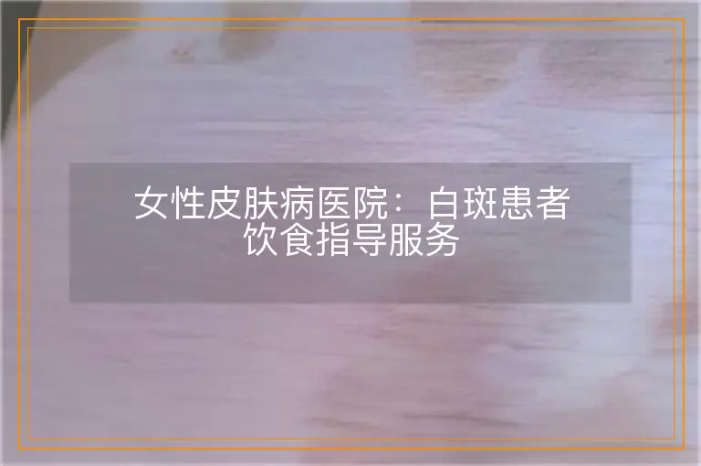 女性皮肤病医院:白斑患者饮食指导服务