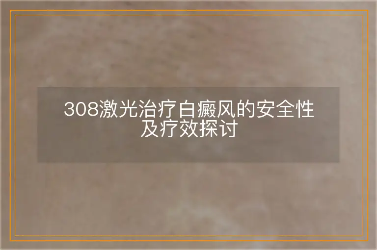 308激光治疗白癜风的安全性及疗效探讨