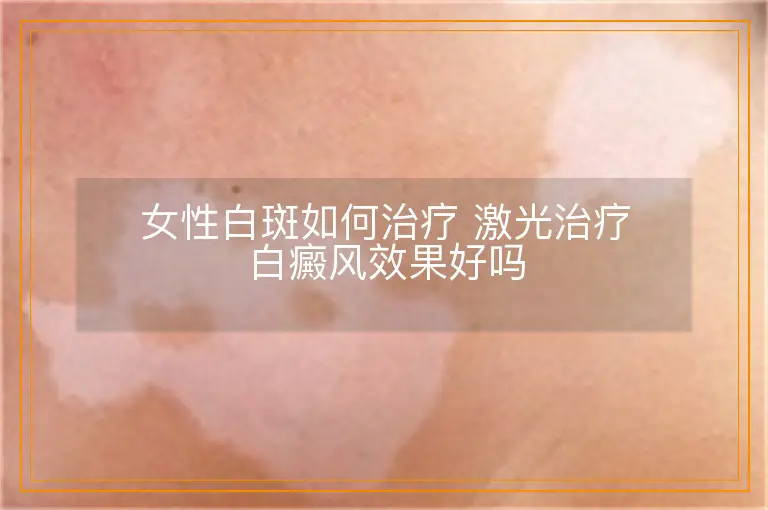 女性白斑如何治疗 激光治疗白癜风效果好吗