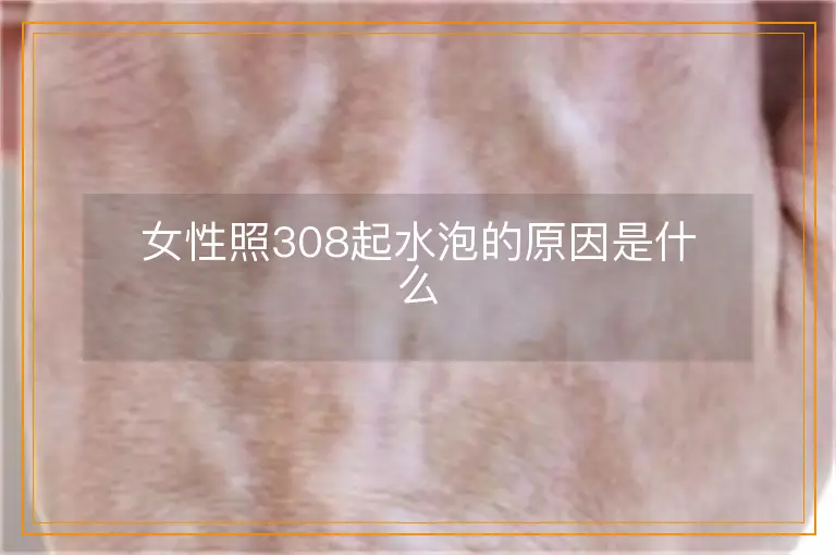女性照308起水泡的原因是什么