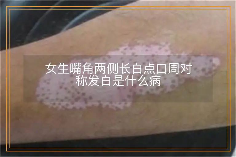 女生嘴角两侧长白点口周对称发白是什么病