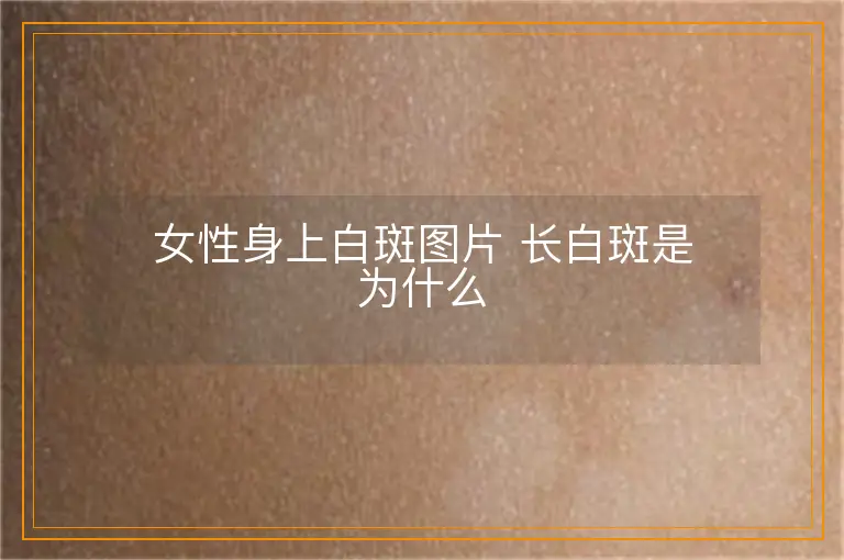 女性身上白斑图片 长白斑是为什么