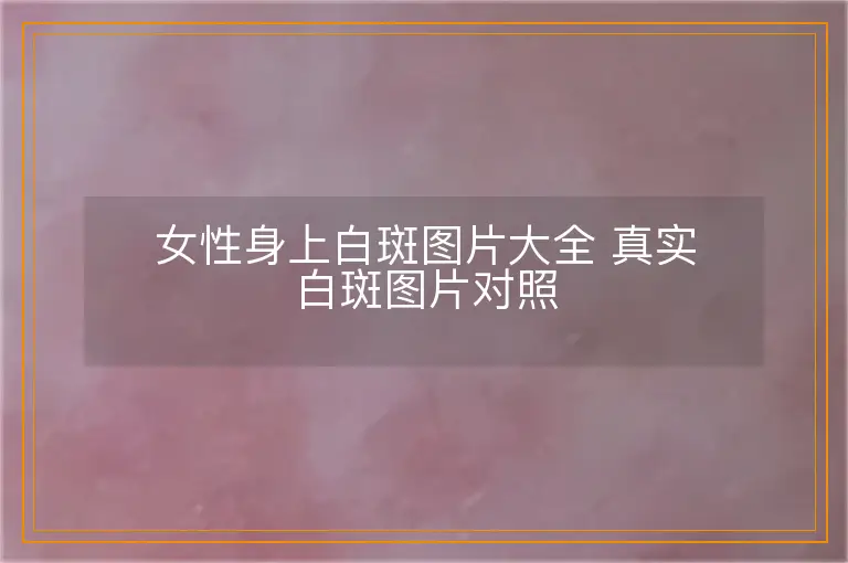 女性身上白斑图片大全 真实白斑图片对照
