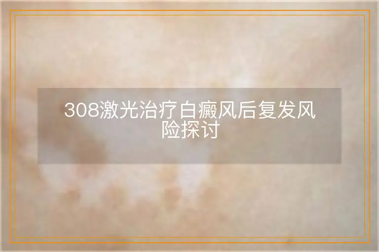 308激光治疗白癜风后复发风险探讨