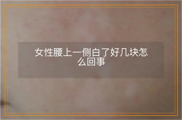 女性腰上一侧白了好几块怎么回事