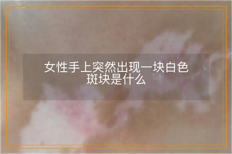 女性手上突然出现一块白色斑块是什么