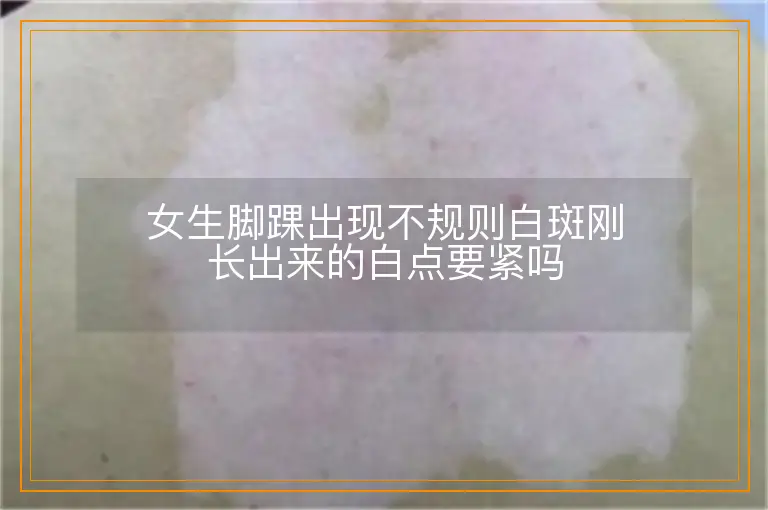 女生脚踝出现不规则白斑刚长出来的白点要紧吗