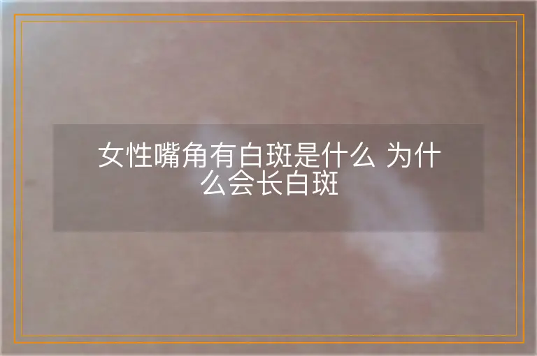 女性嘴角有白斑是什么 为什么会长白斑