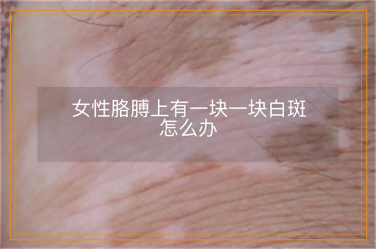 女性胳膊上有一块一块白斑怎么办