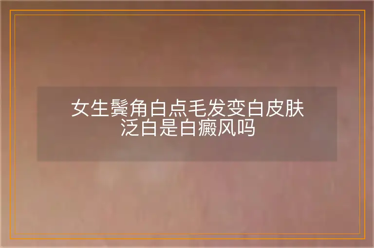女生鬓角白点毛发变白皮肤泛白是白癜风吗