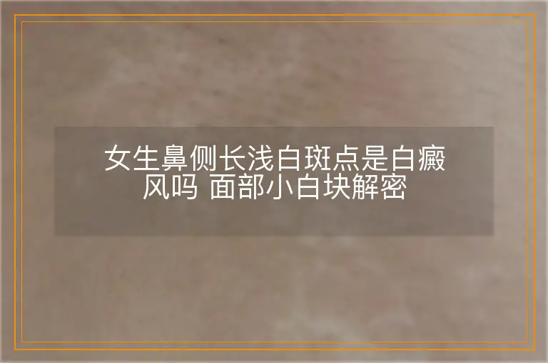 女生鼻侧长浅白斑点是白癜风吗 面部小白块解密
