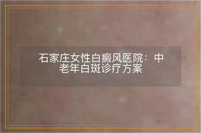 石家庄女性白癜风医院：中老年白斑诊疗方案