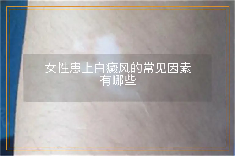 女性患上白癜风的常见因素有哪些