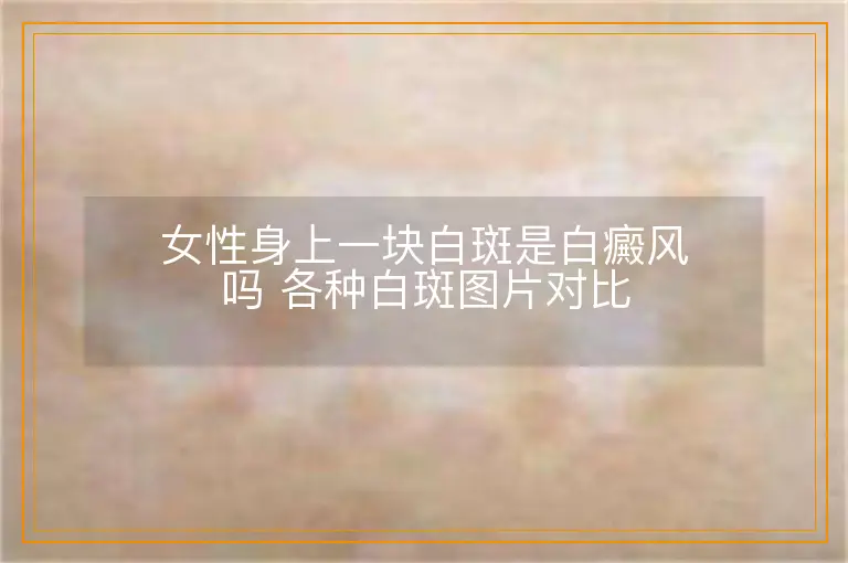 女性身上一块白斑是白癜风吗 各种白斑图片对比