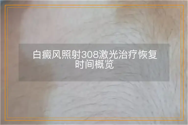 白癜风照射308激光治疗恢复时间概览