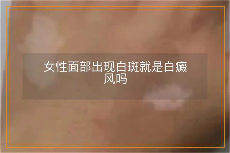女性面部出现白斑就是白癜风吗