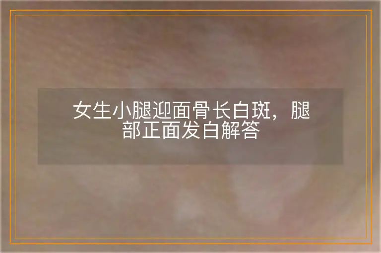 女生小腿迎面骨长白斑，腿部正面发白解答