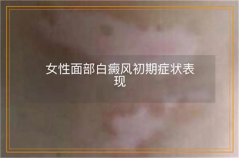 女性面部白癜风初期症状表现