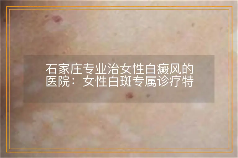石家庄专业治女性白癜风的医院：女性白斑专属诊疗特色盘点